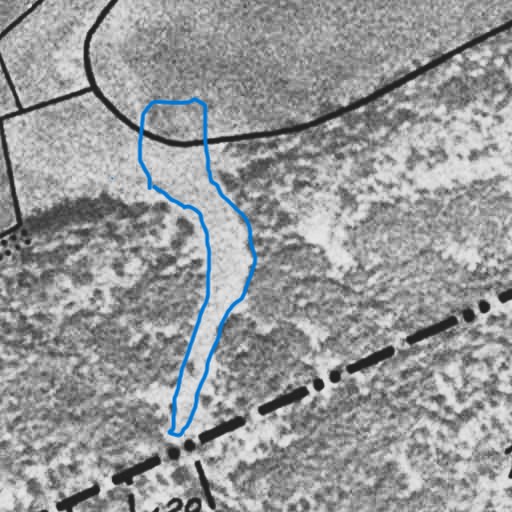 Ekonomiska kartan 1960 med backens första huggning